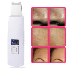 Load image into Gallery viewer, Ultrasonic Skin Scrubber