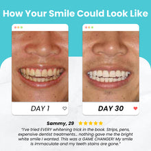 Load image into Gallery viewer, U Shaped Electric Toothbrush