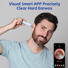 Load image into Gallery viewer, NE10 Visual Ear Cleaner