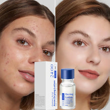 Load image into Gallery viewer, Salicylic Acid Anti-Acne Essence