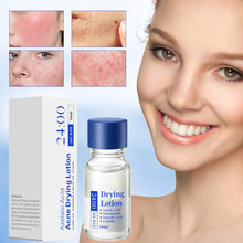Load image into Gallery viewer, Salicylic Acid Anti-Acne Essence