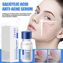 Load image into Gallery viewer, Salicylic Acid Anti-Acne Essence