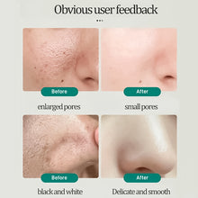 Load image into Gallery viewer, Southern Xiehe Niacinamide Whitening Facial Cleanser