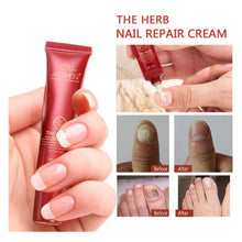 Load image into Gallery viewer, Nail Care Treatment of Anti-Fungal Cream