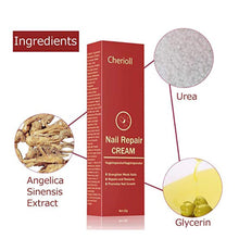 Load image into Gallery viewer, Nail Care Treatment of Anti-Fungal Cream
