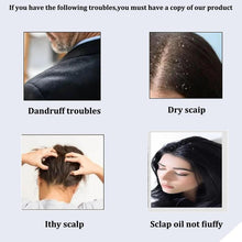Load image into Gallery viewer, Anti-dandruff Massage Comb