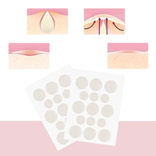Load image into Gallery viewer, Skin Care Acne Care Pimple Patch Absorbing Cover, 30 Count