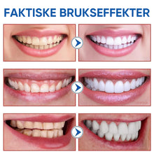 Load image into Gallery viewer, SP10 Probiotisk tannkrem