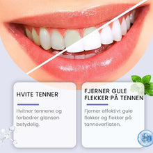Load image into Gallery viewer, 7,5 % Nano-hydroksyapatitt Tannkrem