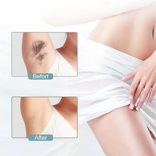 Load image into Gallery viewer, Precise &amp; Gentle Electric Epilator
