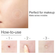 Load image into Gallery viewer, Skin Care Acne Care Pimple Patch Absorbing Cover, 30 Count