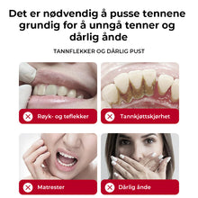 Load image into Gallery viewer, SP-8/SP-10 Probiotisk Whitening Tannkrem for oral helse