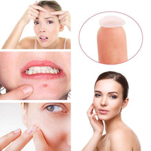 Load image into Gallery viewer, Skin Care Acne Care Pimple Patch Absorbing Cover, 30 Count