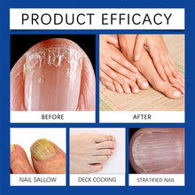 Load image into Gallery viewer, Nail Care Light