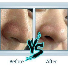 Load image into Gallery viewer, Ultrasonic Skin Scrubber