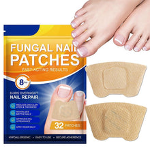 Load image into Gallery viewer, Fungal Nail Patches