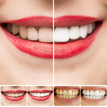 Load image into Gallery viewer, SP-8/SP-10 Probiotisk Whitening Tannkrem for oral helse